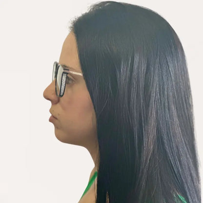 Crystal Elite Vision II – Gafas Multifocales